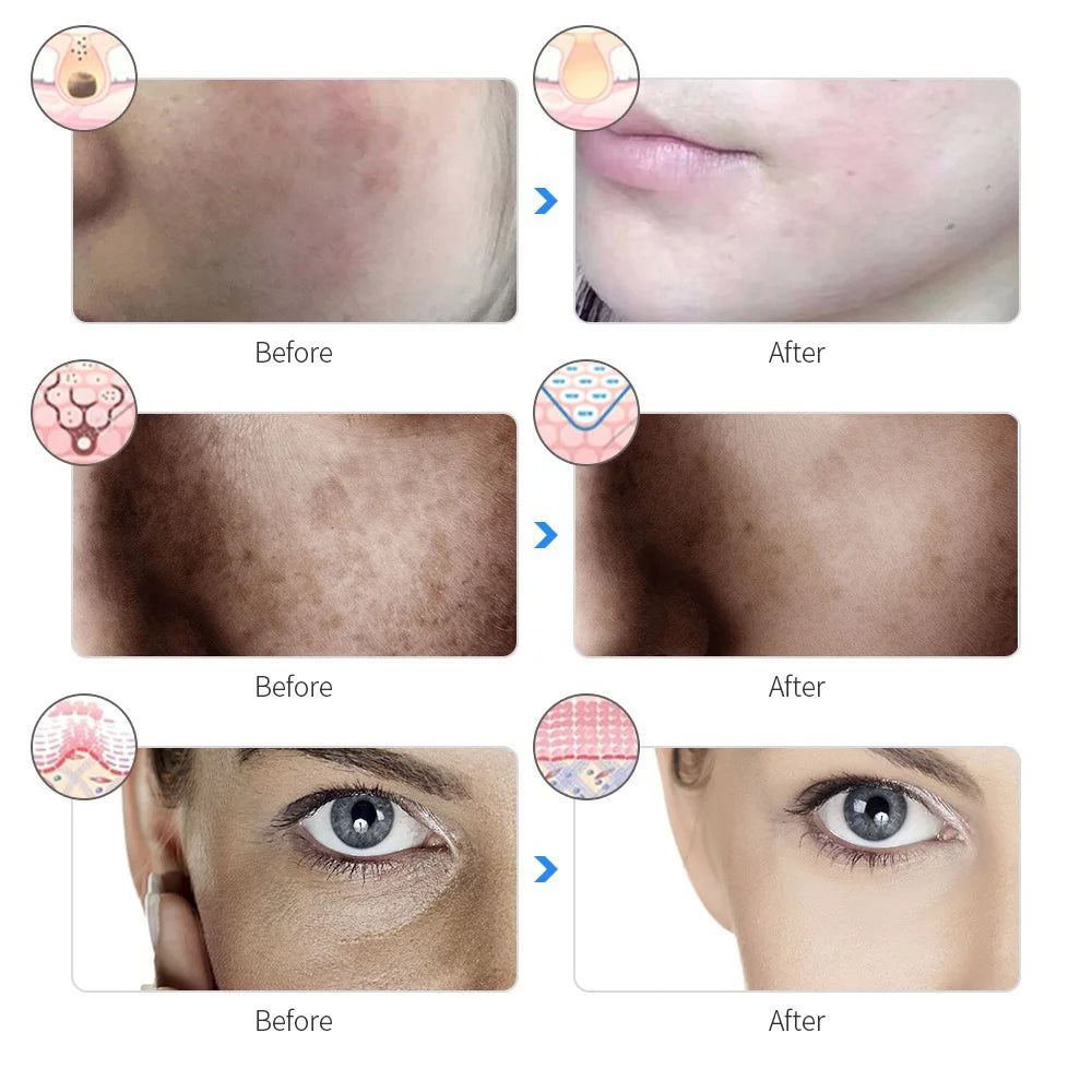 Joliena™ Photon Therapy Beauty Mask
