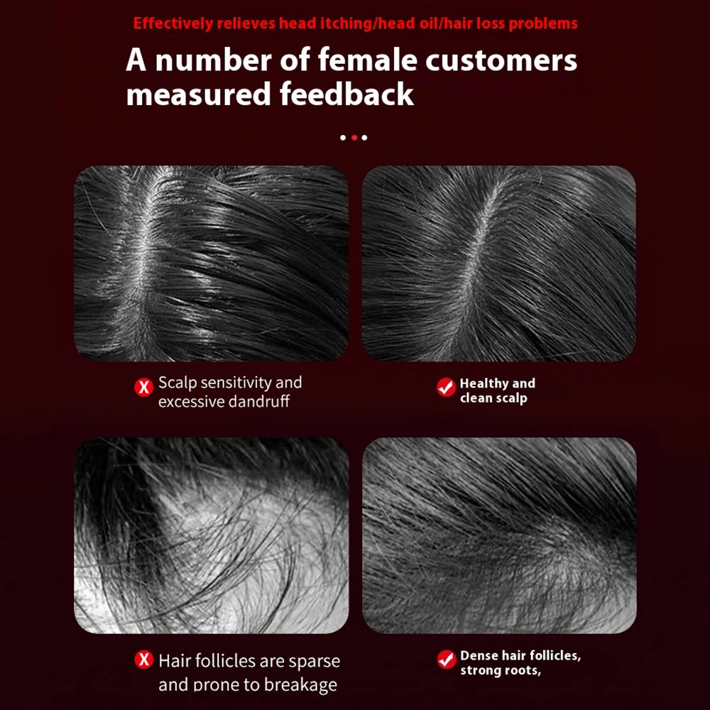 Joliena™ Electric Vibration Massage Comb Portable Hair Follicle Comb