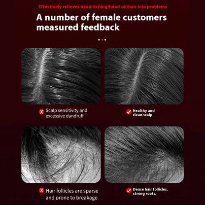 Joliena™ Electric Vibration Massage Comb Portable Hair Follicle Comb